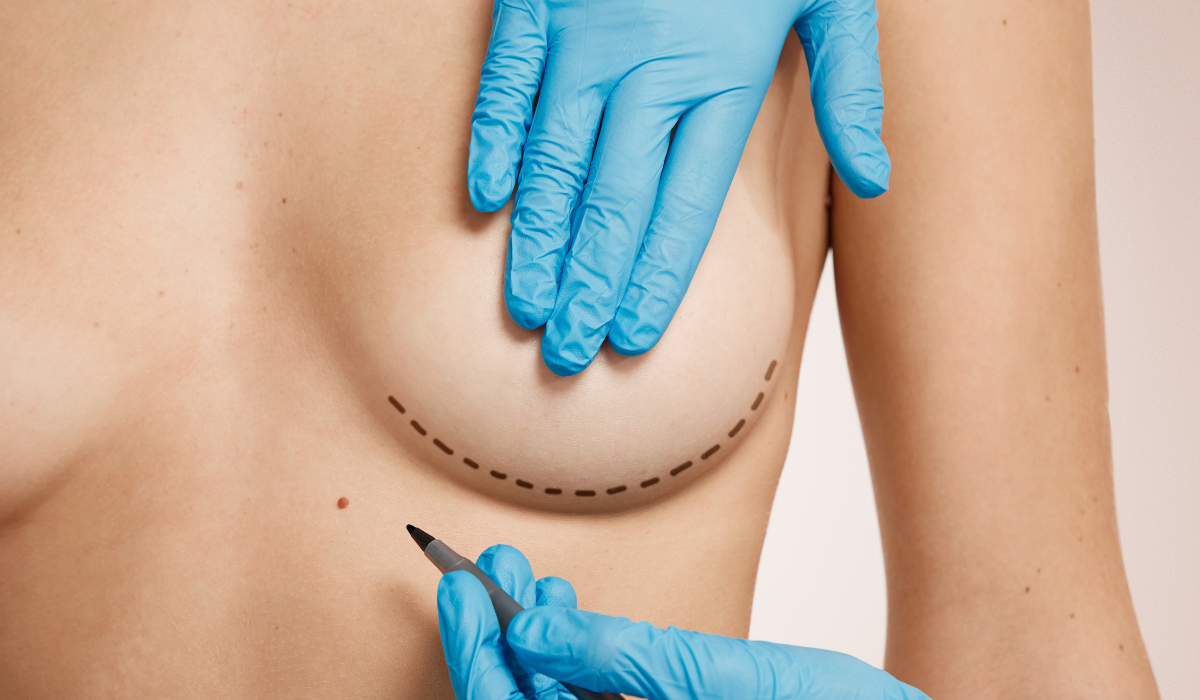 cirurgia plástica Fortaleza Dr Dalvo Neto